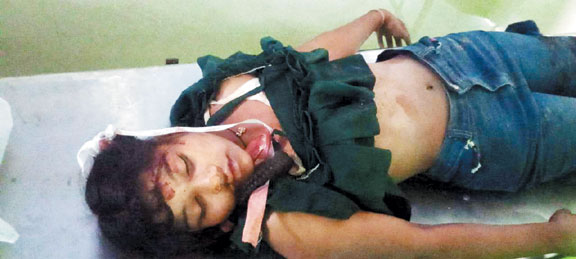  वाहन की चपेट में छात्रा की मौत 3 बाल-बाल बचे