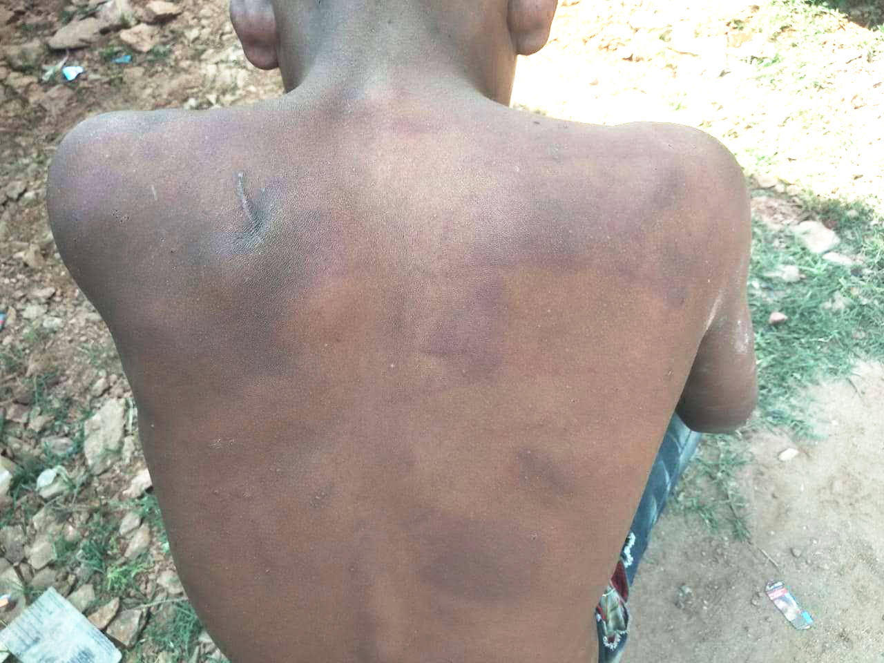 मोबाइल चोरी के आरोप  में युवक की पिटाई 