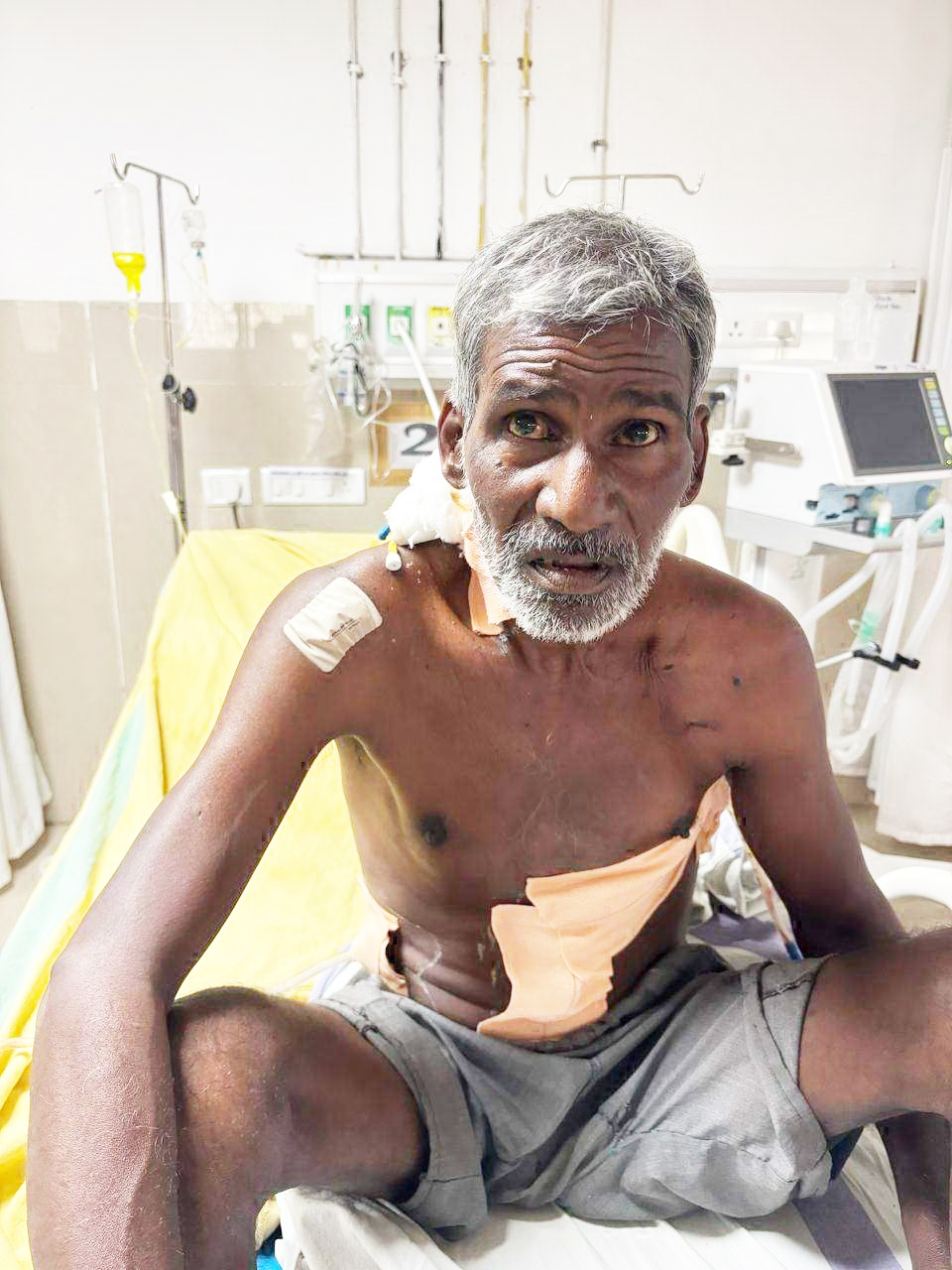सडक़ दुर्घटना में घायल का मेडिकल कॉलेज रायगढ़ में ऑपरेशन सडक़ दुर्घटना में घायल का मेडिकल कॉलेज रायगढ़ में ऑपरेशन