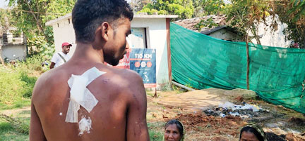 मां के सामने बेटे पर चाकू से हमला