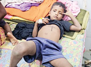 भतीजे पर एयरगन से चलाई गोली, सीने में फंसी है