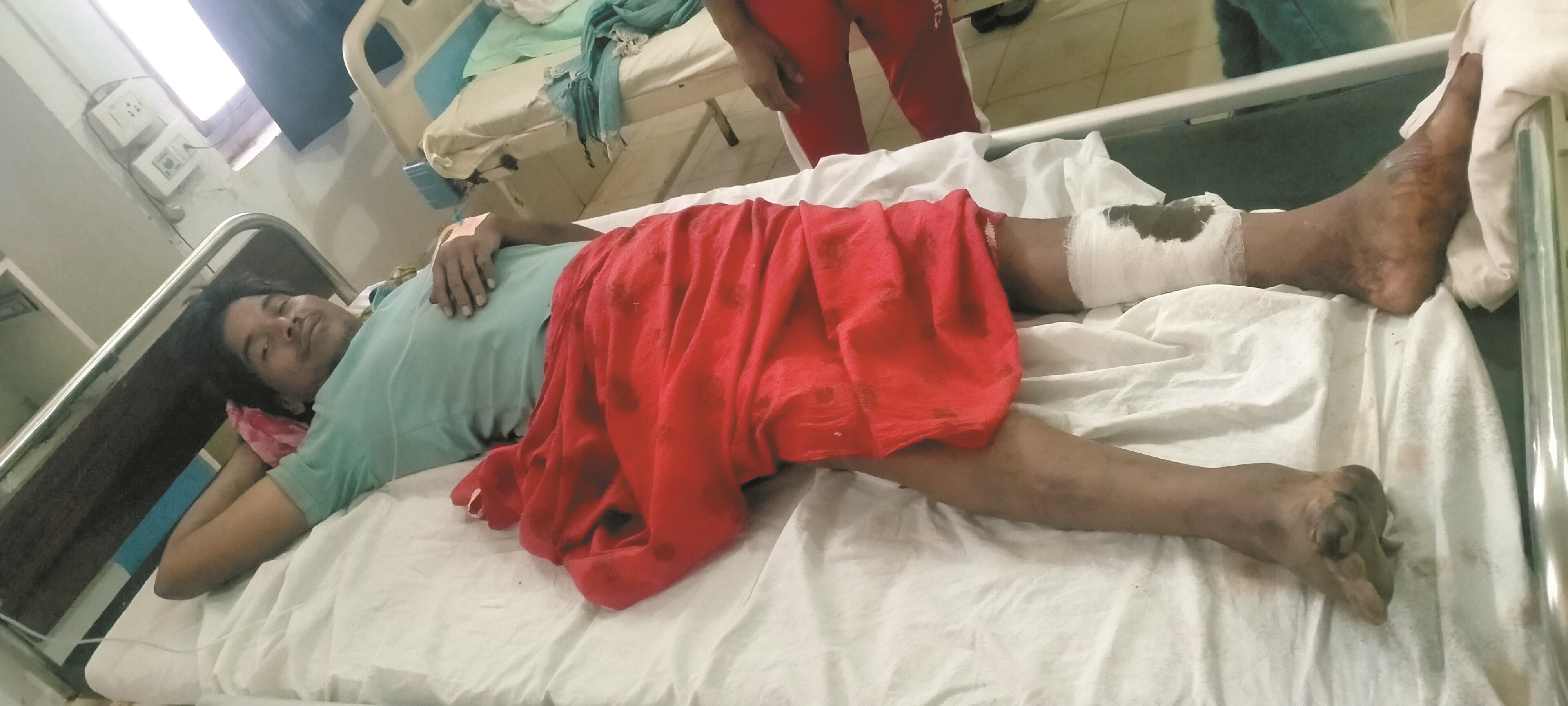 भालू के हमले से ग्रामीणजख्मी भालू के हमले से ग्रामीणजख्मी