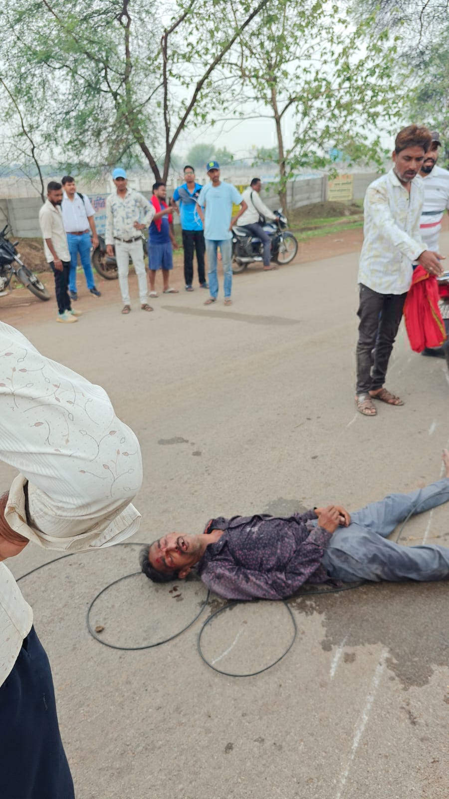 वायर में फंसने से बाइक  चालक गिरा, गंभीर