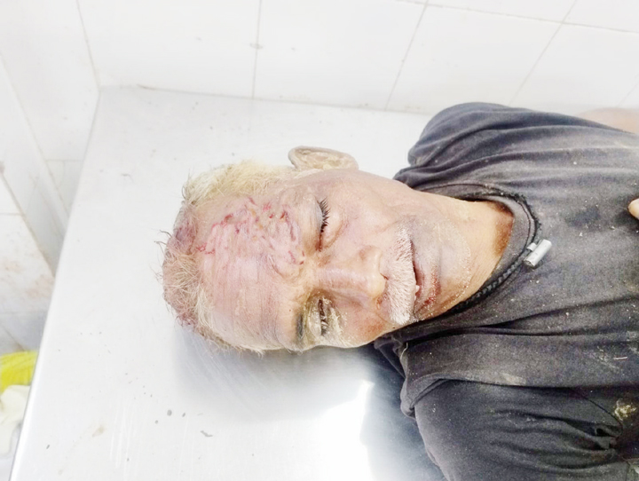 जमीन विवाद  चचेरे भाई पर प्राणघातक हमला