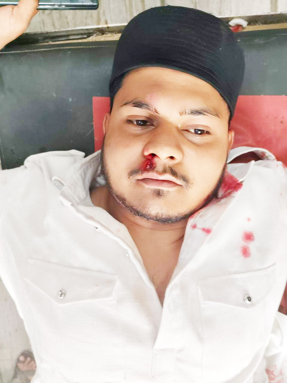 हत्या के आरोपी ने जमानत पर बाहर आते ही साथियों संग सरेराह युवक पर किया कातिलाना हमला हत्या के आरोपी ने जमानत पर बाहर आते ही साथियों संग सरेराह युवक पर किया कातिलाना हमला