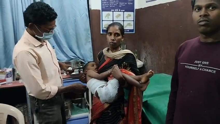 मासूम गरम चाय से झुलसा, गंभीर मासूम गरम चाय से झुलसा, गंभीर