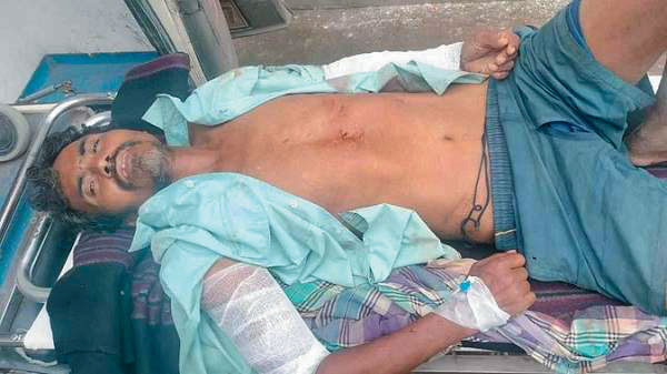 हाथी का हमला, ग्रामीण घायल हाथी का हमला, ग्रामीण घायल