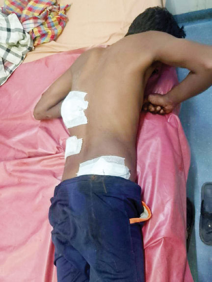 पिता ने बेटे को मारा चाकू पिता ने बेटे को मारा चाकू