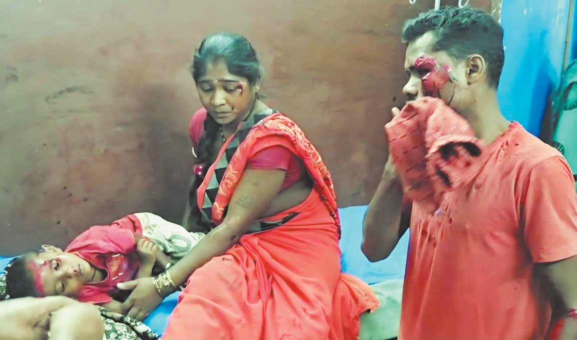 बाइक के सामने आया कुत्ता, मासूम समेत 4 जख्मी