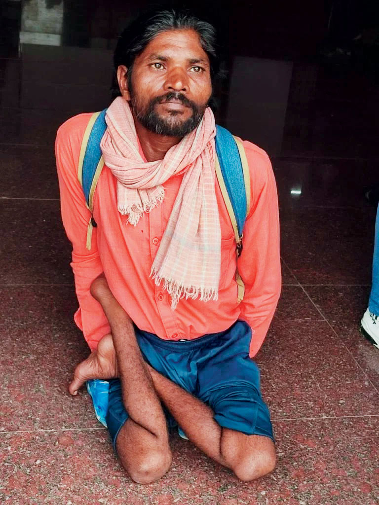 80 फीसदी दिव्यांग, फिर भी योजनाओं का नहीं मिल रहा लाभ, 11 साल से दफ्तरों के चक्कर