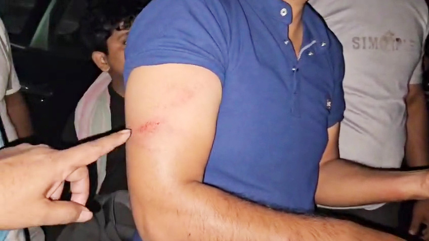 सराफा कारोबारी पर नकाबपोशों का हमला,  जख्मी