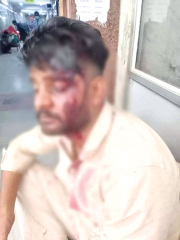 उर्स के दौरान एक युवक पर बेसबॉल स्टिक, रॉड से हमला