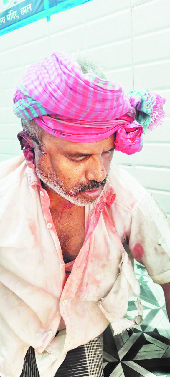 चाकूबाजी मारकर कबाड़ी से लूट