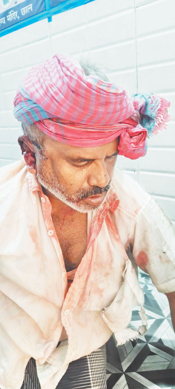 चाकूबाजी मारकर कबाड़ी से लूट