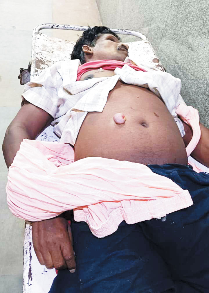 छछानपैरी में हत्या, चाकू मार अतड़ी बाहर निकाला