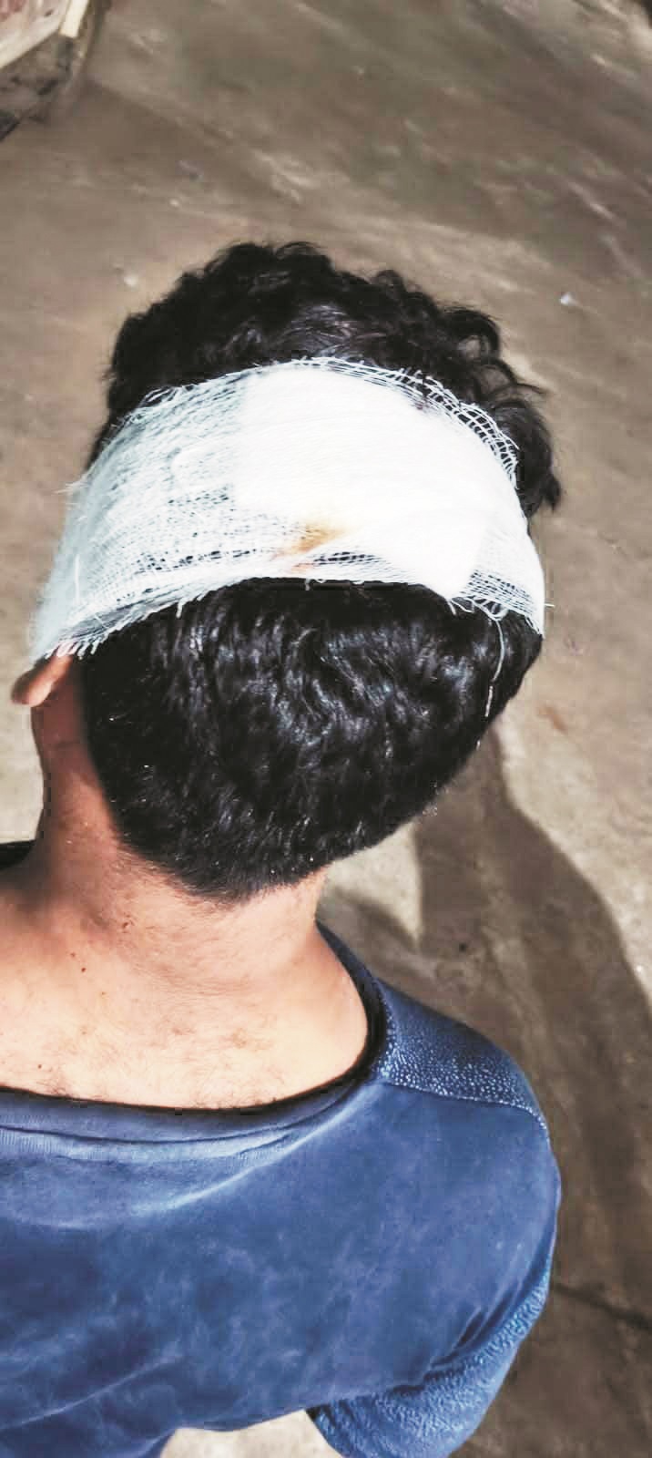 भाटापारा में युवा कांग्रेस महासचिव पर हमला पुलिस कार्रवाई को लेकर कई आरोप