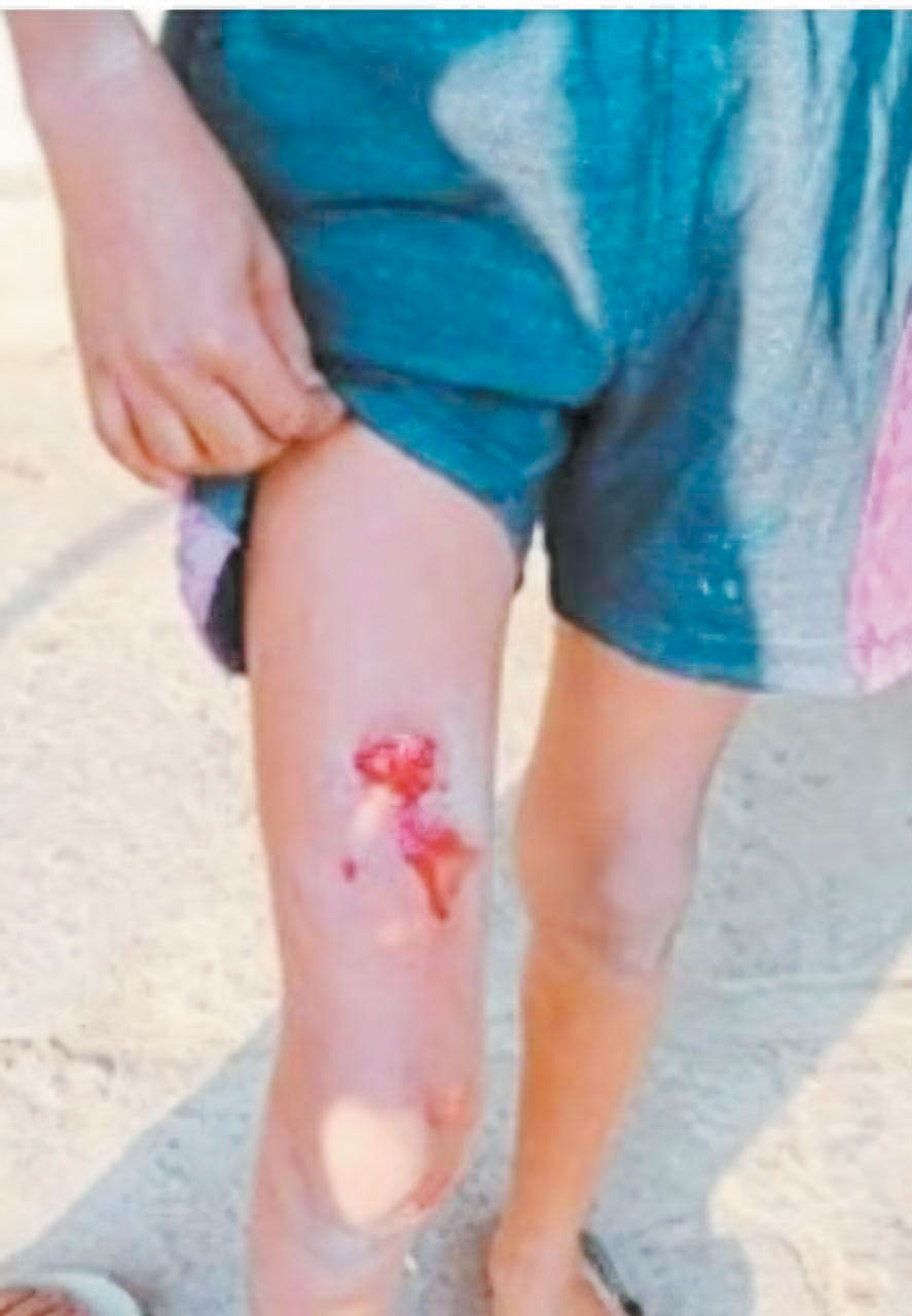 संबलपुर में बंदर का आतंक, बालक को काटा