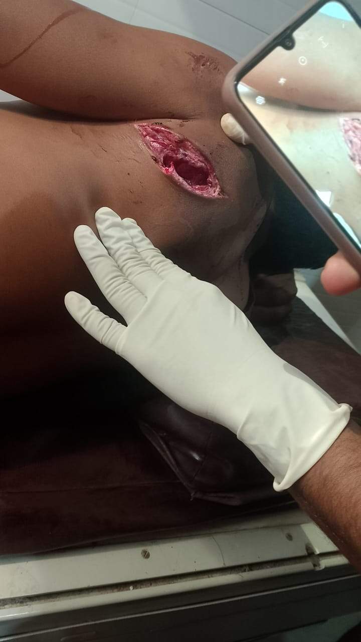 शिक्षादूत पर भालू का हमला, महाराष्ट्र के अस्पताल में भर्ती