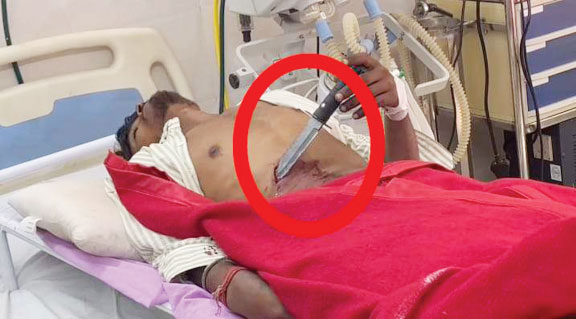 दिनदहाड़े चाकूबाजी, दुकान में युवक पर जानलेवा हमला