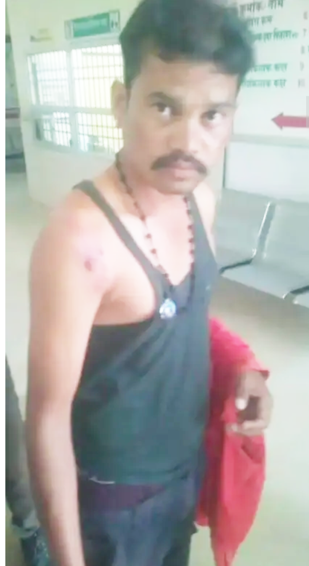 कुत्तों ने बच्चे समेत 5 को काटा