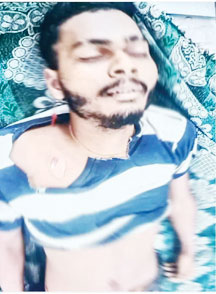 मामूली विवाद, वन चौकीदार के हमले से युवक की मौत