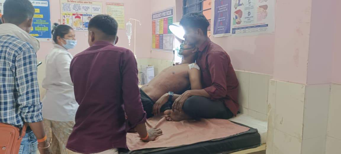 20 रुपये के लेन-देन पर चाकूबाजी,   2 युवक जख्मी