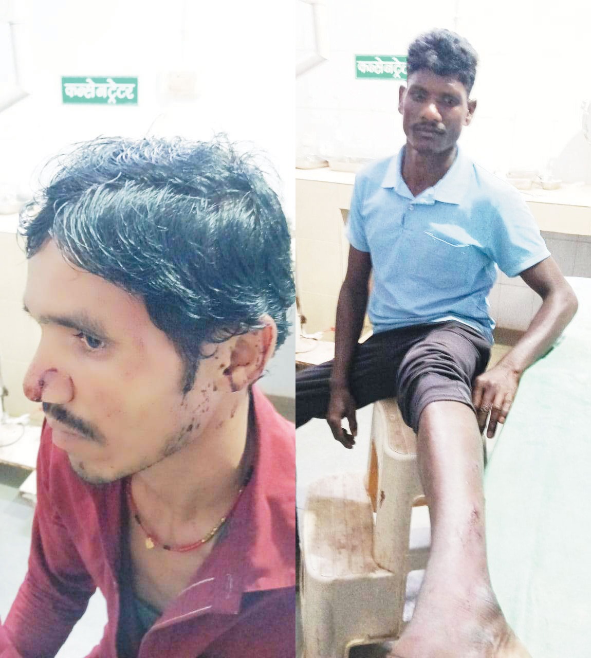 तेंदुए के हमले से दो ग्रामीण जख्मी