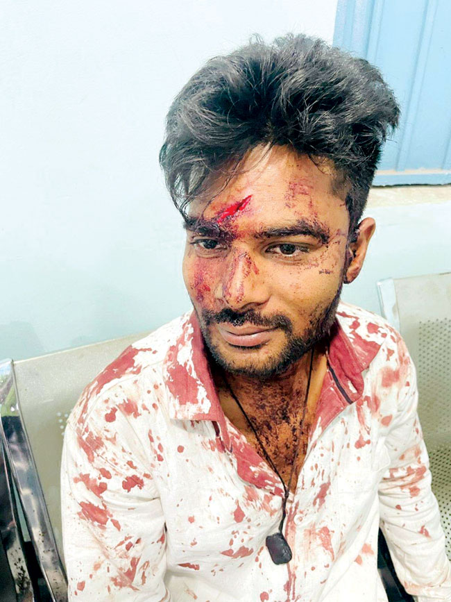 कांशीराम नगर में हाफ मर्डर, सिलतरा ढाबे में तोडफ़ोड़- मारपीट