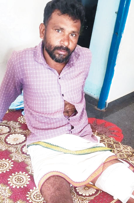 जंगली सुअर के हमले से किसान जख्मी