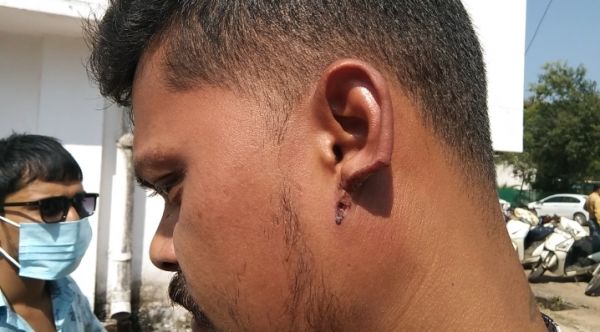 कान और उंगली काटने की पुलिस से शिकायत