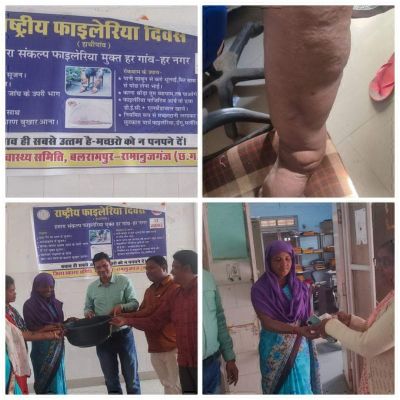 धमतरी के बाद फाइलेरिया उन्मूलन की ओर अग्रसर