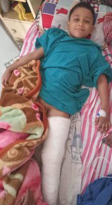 बलरामपुर जिला अस्पताल में बिहार के 6 वर्षीय बच्चे का सफल ऑपरेशन