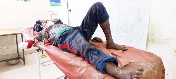 ढलान पर अनियंत्रित होकर ट्रक पलटा, ड्राइवर गंभीर