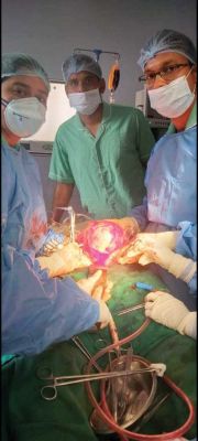   एनिमिक 40 वर्षीय महिला का गर्भाशय की गांठ का ऑपरेशन सफल रहा