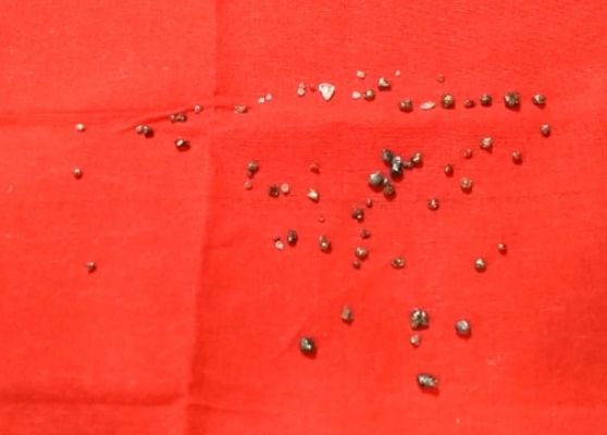 71 हीरे आरोपी गिरफ्तार