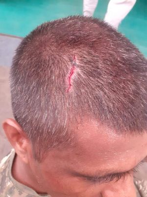 सुकमा के एलमागुंडा कैंप पर नक्सलियों का हमला, 3 जवान घायल