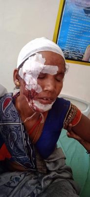 बाइकों में भिड़ंत, 5 घायल, एक को जिला चिकित्सालय भेजा