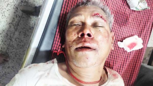 अधेड़ पर तलवार से हमला, इलाज के लिए रायपुर भेजा