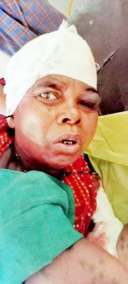 लकड़ी बीनने जंगल गई वृद्धा पर भालू ने किया हमला, घायल