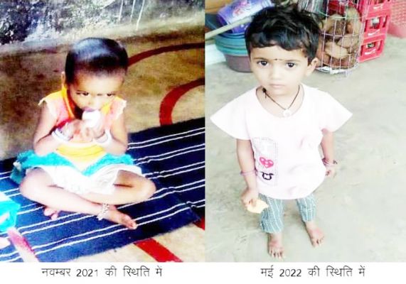 मुख्यमंत्री सुपोषण योजना से रेशमा की सेहत में आयी सुधार
