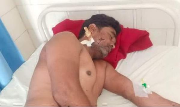 चिल्फी में ट्रक ड्राइवर से लूटपाट के बाद मारी गोली, गंभीर