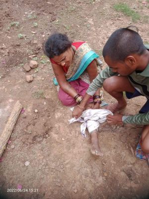 पारिवारिक विवाद: भाभी के पैर पर मारा सब्बल, घायल