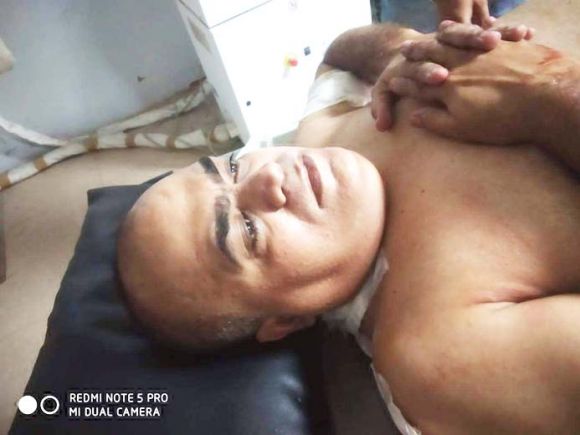 लूट में नाकाम व्यापारी पर जानलेवा हमला