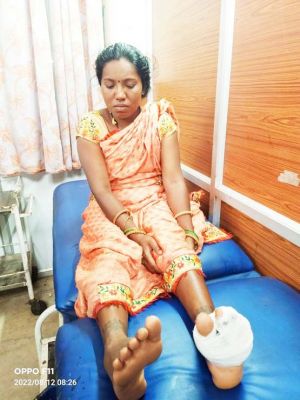 भालू के हमले से महिला घायल खरसिया वन परिक्षेत्र की घटना