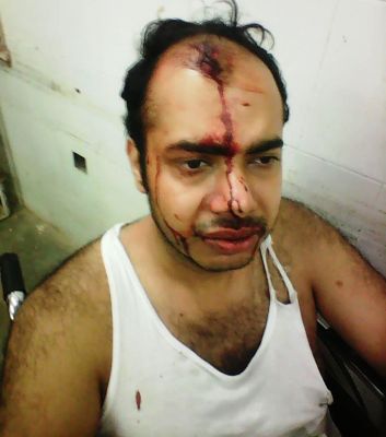 सोनहत विधायक के पीएस पर अपने जीजा से मारपीट का आरोप, पीड़ित ने विधायक पांडेय से लगाई मदद की गुहार