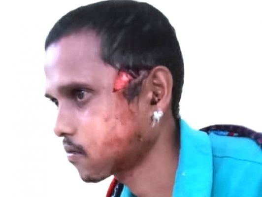 खेत से पानी निकालने गए युवकों पर भालू का हमला, एक के सिर दूसरे के हाथ से नोचा मांस