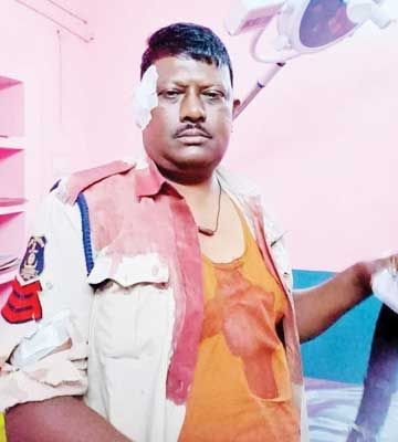 112 टीम पर आरोपी ने किया टांगी से हमला