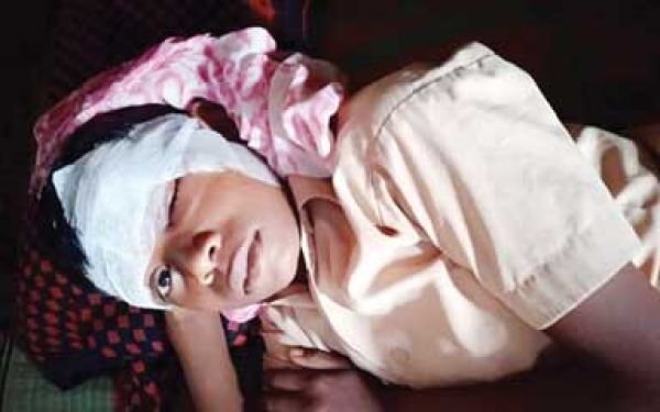 आरंग के भानसोज स्कूल में पंखा गिरने से छात्र घायल