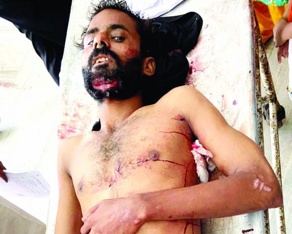 लूडो खेल रहे युवकों ने राड-चाकू से किया हमला, एक का फेफड़ा फटा