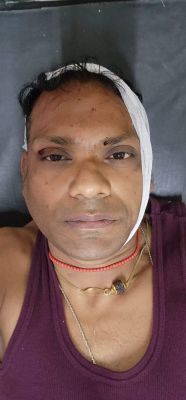 इंजीनियर संजय गायकर सडक़ दुर्घटना में  हुए घायल